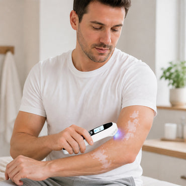 ZJKZTOP 308nm Handheld UVB Light Therapy Device