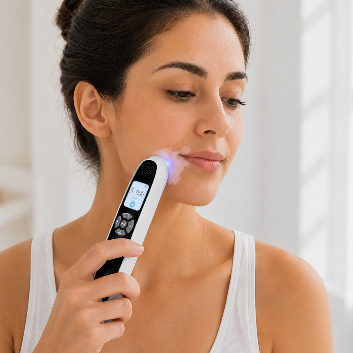Portable 308nm UVB Phototherapy Wand for Vitiligo