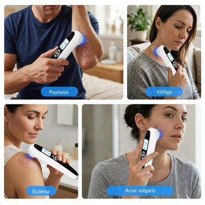 Portable 308nm UVB Phototherapy Wand for Vitiligo
